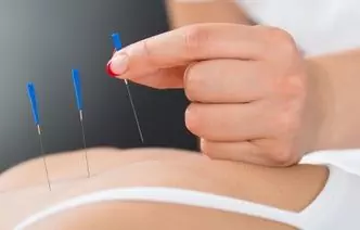 8 Mythes Sur L'acupuncture