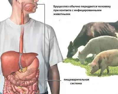 Bruceloza U Ludzi - Patogeny, Diagnostyka, Leczenie