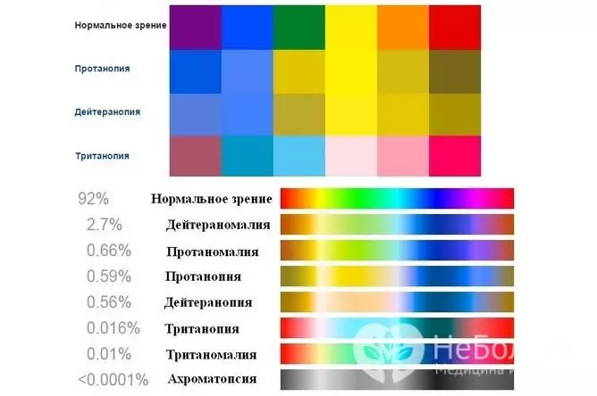 Color blindness: types of color blindness