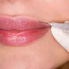 Plástico Labial - Descrição, Tipos, Vantagens E Desvantagens, Comentários