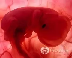 Fetal size at 7 weeks of gestation - 11-14 mm