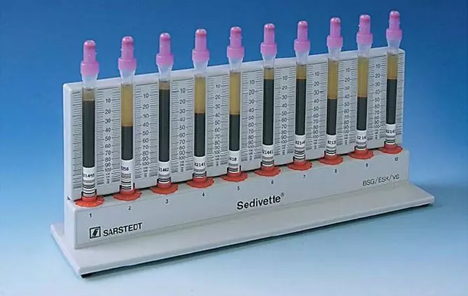 ESR Em Um Exame De Sangue: Qual é A Norma Em Mulheres, Homens E Crianças