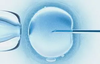 6 Mogućih Komplikacija Nakon IVF-a