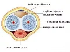 Peyronie liga - fibroplastinis varpos padėties sutrikimas