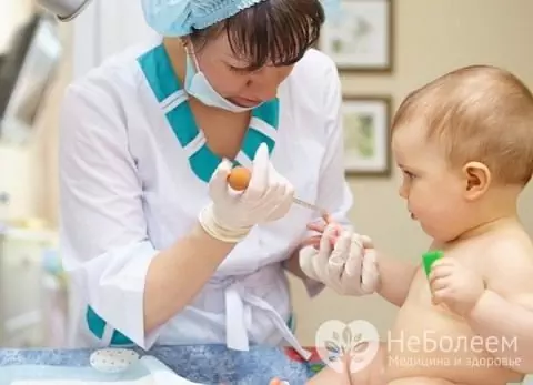 To diagnose the Coxsackie virus, the child's blood is examined