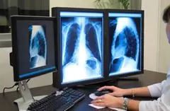 Tomography Of The Lungs - Indications For Conduct, Preparation For Examination