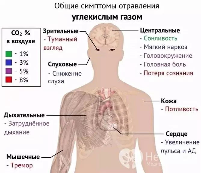 Objawy hiperkapnii