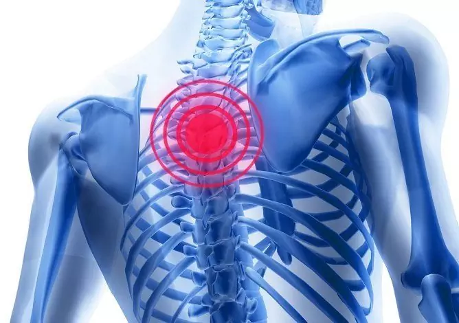 Osteochondrose Der Brust - Symptome, Behandlung, Übungen, Anzeichen