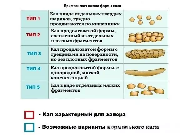 Ce este constipația?