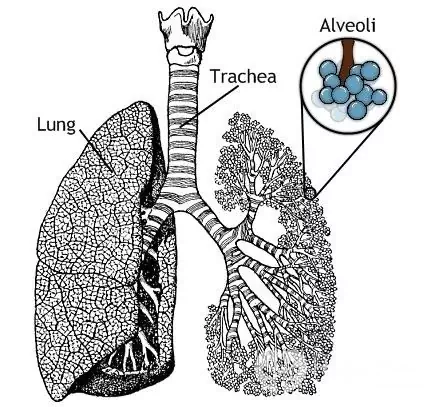 Silicosis