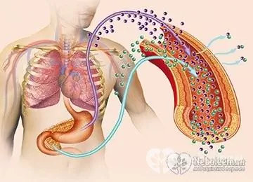 Zollinger-Ellisonov syndróm - príznaky a diagnostika