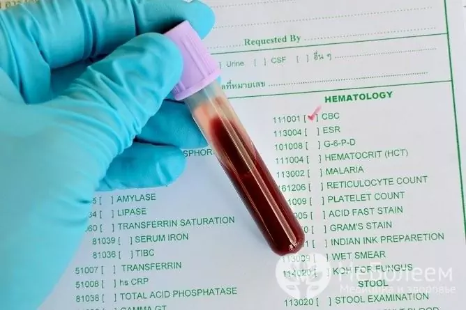 To identify the causative agent of syphilis in men, blood and cerebrospinal fluid are tested