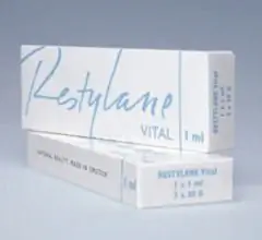 Restylane Injections - Reviews, Indications For Use