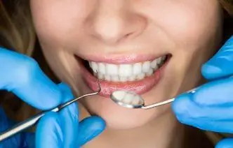 O Implante Se Tornou Uma Opção Para Quem Perdeu Vários Dentes De Uma Vez