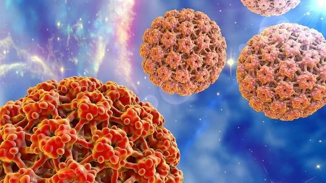 Papillomavirus Umano Negli Uomini: Sintomi, Trattamento, Foto, Come Viene Trasmesso