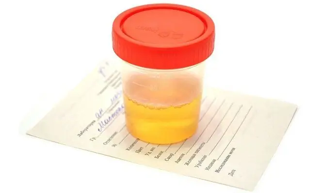 Is It Possible To Pass A Urine Test During Menstruation, Preparation And Collection Rules