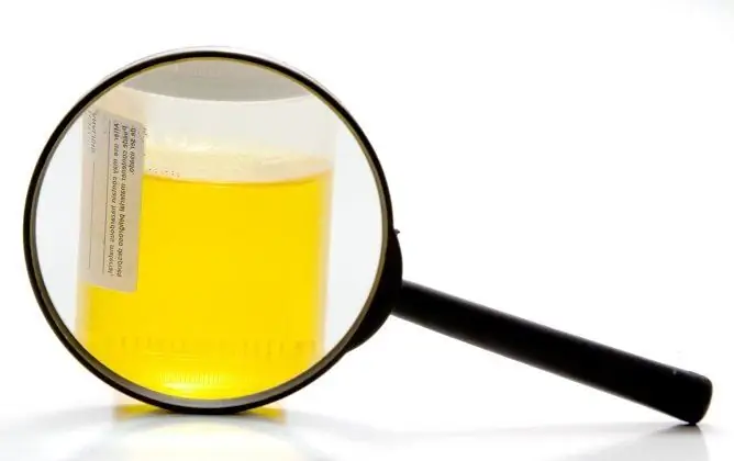 Come Eseguire Correttamente Un Test Delle Urine: Preparazione, Raccolta Per Un'analisi Generale