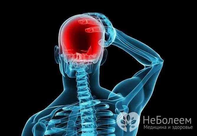 Increased intracranial pressure manifests itself mainly as a headache