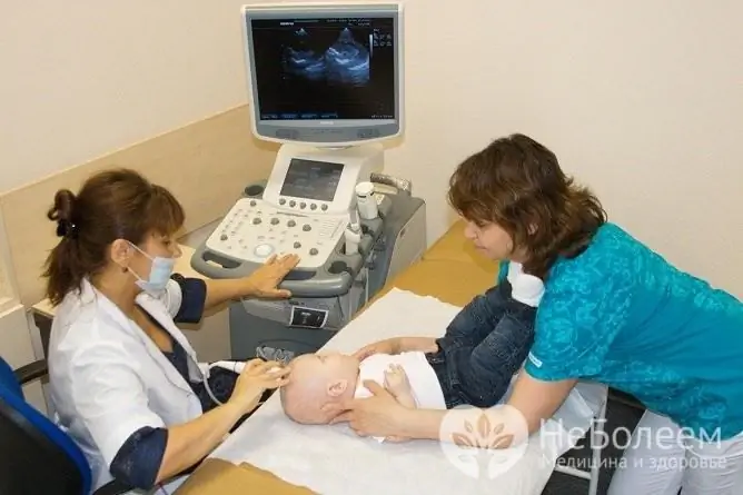 Neurosonography is an effective and safe method for diagnosing intracranial hypertension in infants