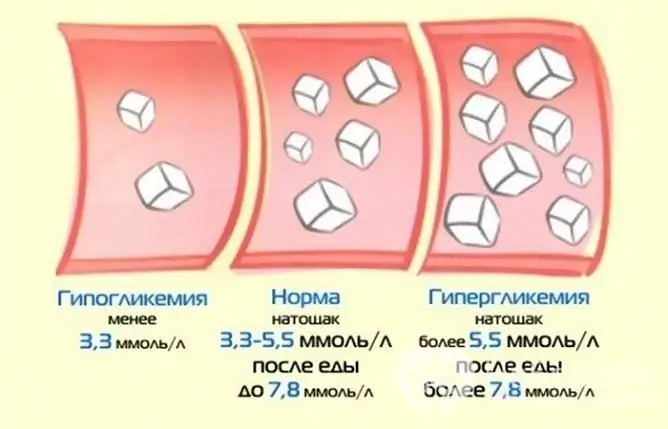 Increased blood sugar is called hyperglycemia