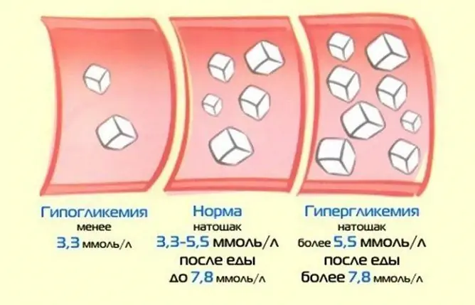 Висока кръвна захар: симптоми, причини, диета