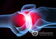 Az ízületi fájdalom egyik oka az osteoarthritis