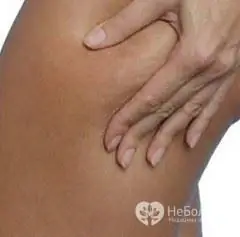 Vous pouvez vous débarrasser de la cellulite sur les jambes en utilisant un régime spécial