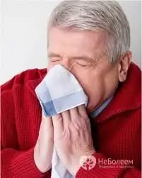 Persistent runny nose