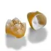 Dental Crown Prosthetics