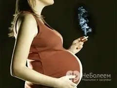 Smoking during pregnancy is dangerous for the baby