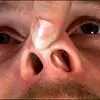 Why Is The Curvature Of The Nasal Septum Dangerous?