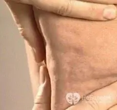 Questa lotta implacabile contro la cellulite: metodi