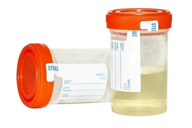 How Much Urine Is Needed For Analysis In Infants, Children And Adults