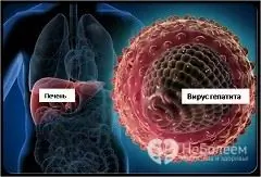 Hepatitt B-virus