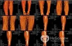 Tomografi yang dikira spiral boleh dipercayai, cepat dan tepat