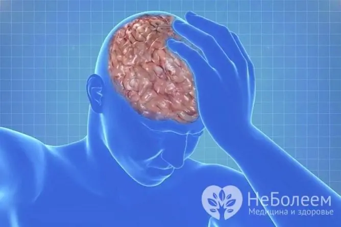 Hematoma subdural berlaku akibat kecederaan otak traumatik