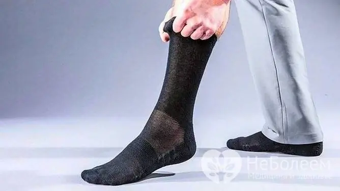 Socken für Hyperhidrose müssen häufig gewechselt werden