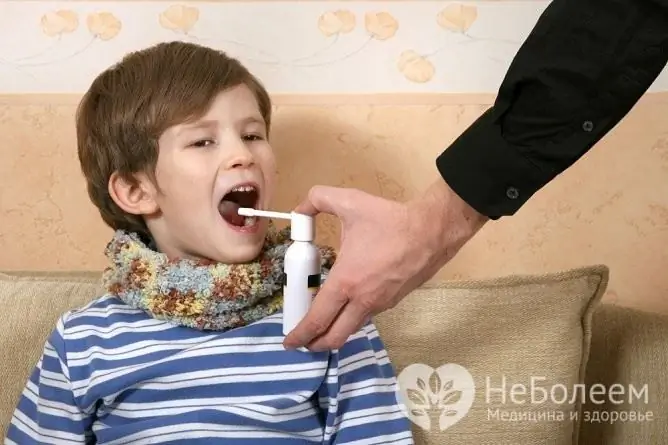 Treatment of tonsillitis and tonsillitis should be carried out under medical supervision