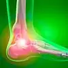 Why Does The Ankle Often Hurt?