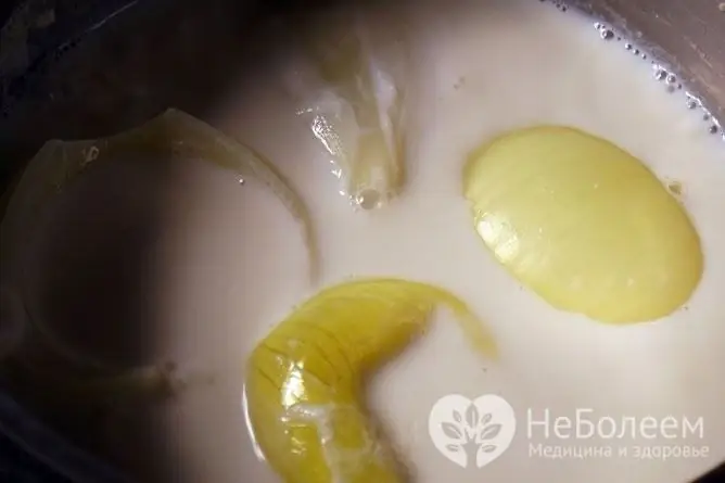 La decocción de cebollas en leche con miel es uno de los remedios caseros populares para la bronquitis