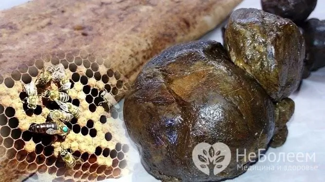 Homemade propolis medications can be helpful for bronchitis