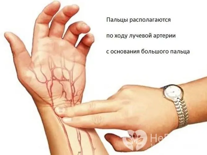 Pulse is usually measured on the radial artery, although it is possible on any large, superficial