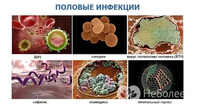 Czynniki wywołujące choroby przenoszone drogą płciową