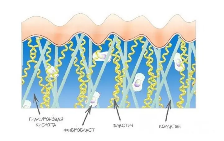 Hyaluronic acid safety profile