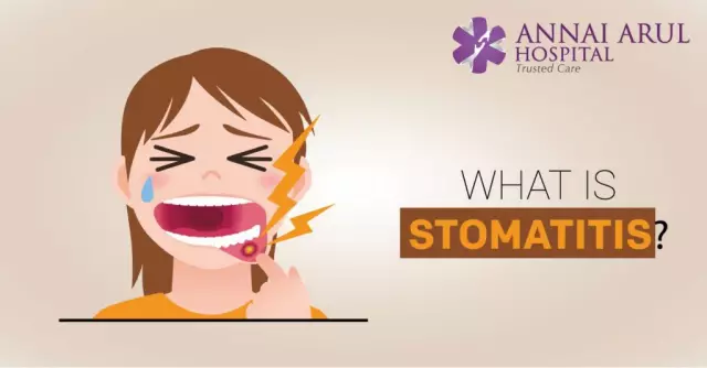 Stomatitis In Children, Treatment