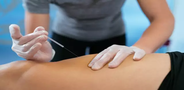 Acupuncture - Reviews, Types, Application