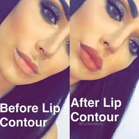 Lip Contouring - Methods, Conduct, Reviews