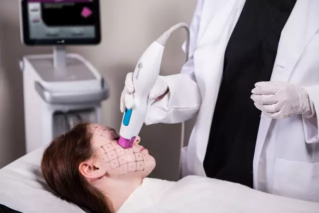 Thermage Procedure - Reviews, Indications, Application