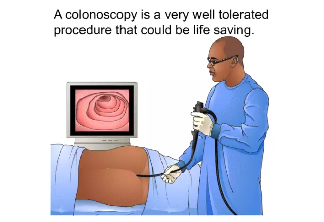 Colonoscopy - Indications, Preparation, Complications