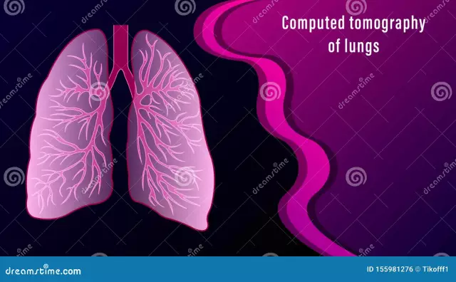 Tomography Of The Lungs - Indications For Conduct, Preparation For Examination